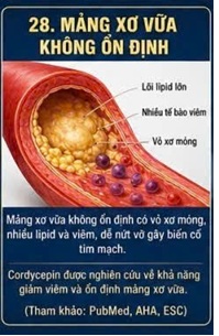 CORDYCEPIN VÀ TẾ BÀO BỌT (FOAM CELL) – BƯỚC NGOẶT QUAN TRỌNG TRONG QUÁ TRÌNH XƠ VỮA ĐỘNG MẠCH