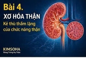 ĐÔNG TRÙNG HẠ THẢO VÀ CHỈ SỐ CREATININE MÁU: GÓC NHÌN KHOA HỌC HIỆN ĐẠI