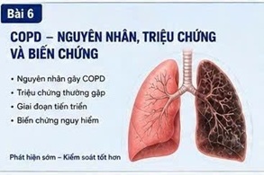 CORDYCEPIN VÀ CÁC CƠ CHẾ SINH HỌC LIÊN QUAN ĐẾN CHỨC NĂNG PHỔI