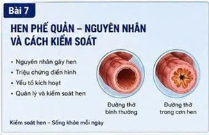 ĐÔNG TRÙNG HẠ THẢO VÀ VIÊM PHẾ QUẢN MẠN: NHỮNG DỮ LIỆU KHOA HỌC MỚI NHẤT